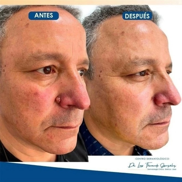 Сыворотка 22937776