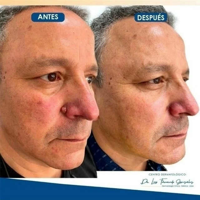 Сыворотка 23060551