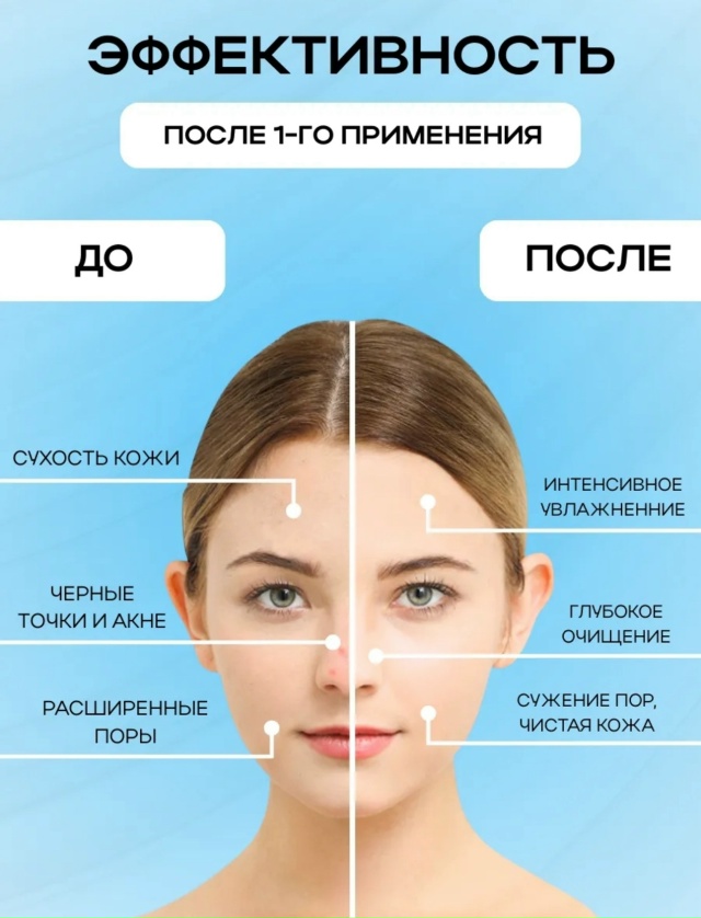 Комплект 23117213