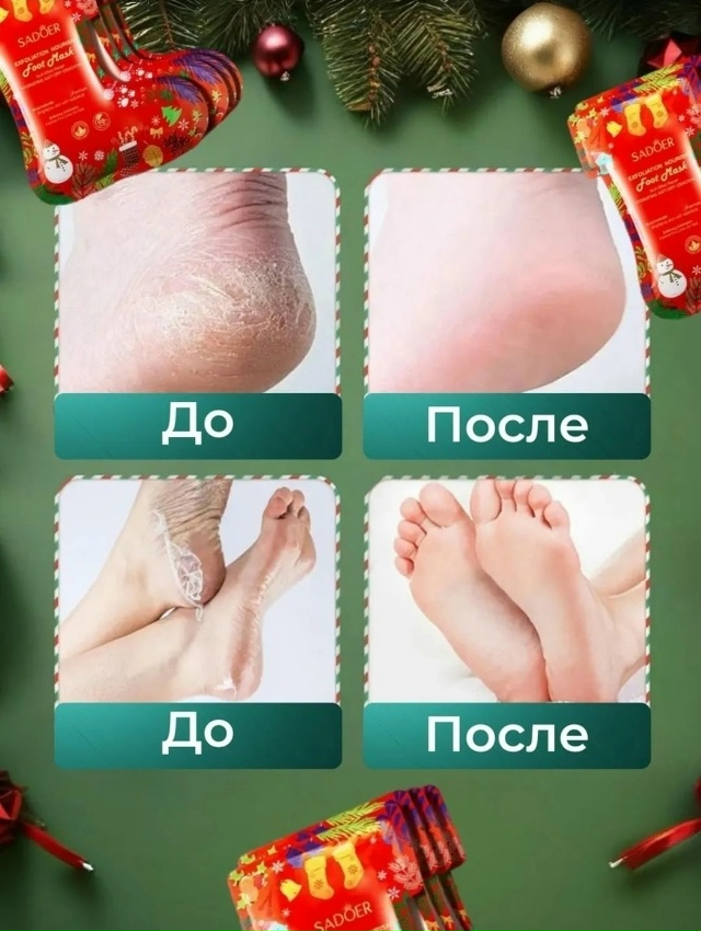 Комплект 23176256